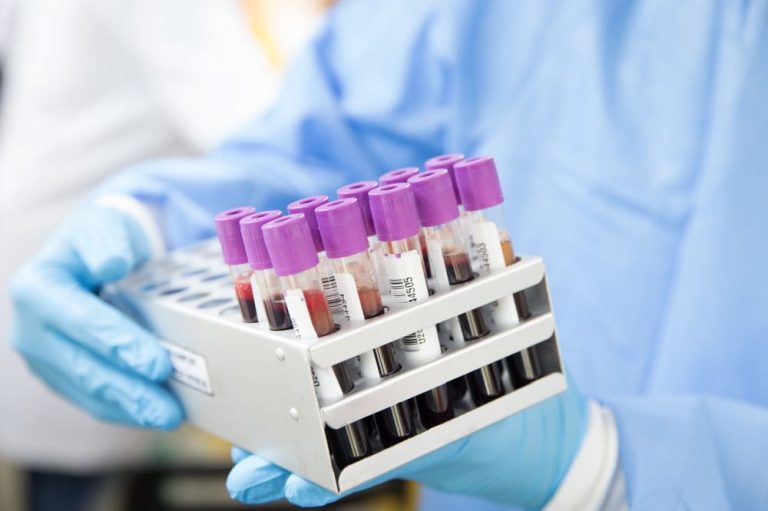 Plasma from recovered patients shows little benefit in those hospitalized with COVID-19  — study