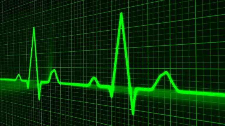 Do you want to be resuscitated? This is what you should think about before deciding
