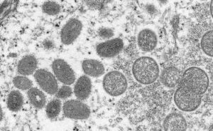 Philippines detects 4th monkeypox case